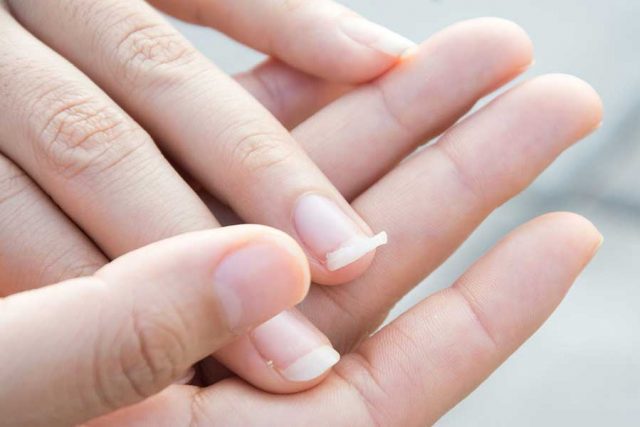 fortifier les ongles cassants