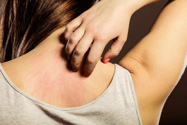 réduire les allergies