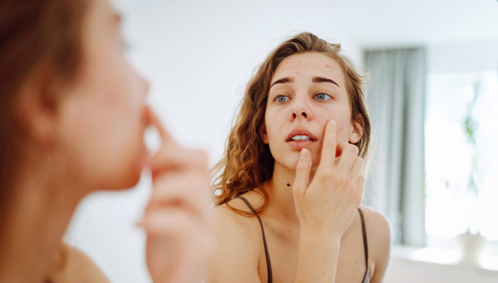 astuces pour camoufler un bouton