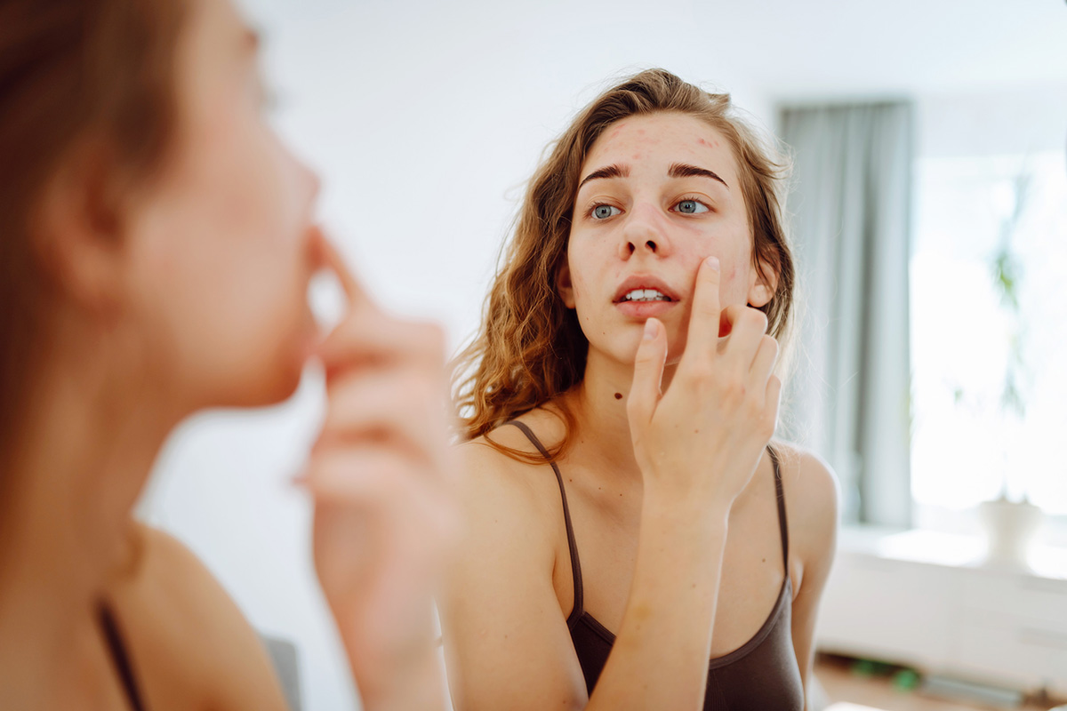 astuces pour camoufler un bouton