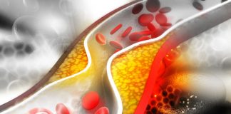 baisser naturellement le cholestérol
