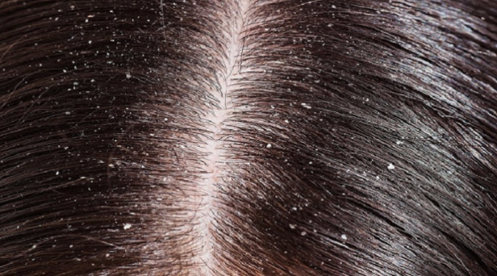 cheveux cheveux