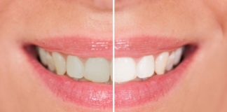 Se blanchir les dents